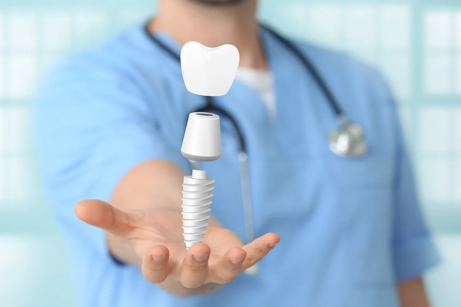 Rodzaje implantów zębowych