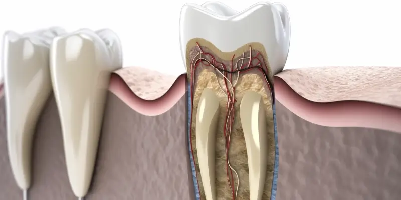 Wszystko co musisz wiedzieć o implantach zębowych