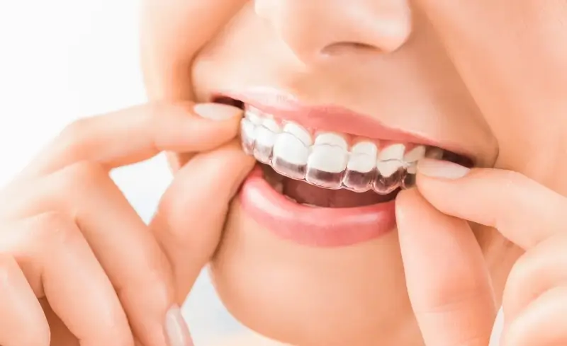 Wybór dobrego dentysty