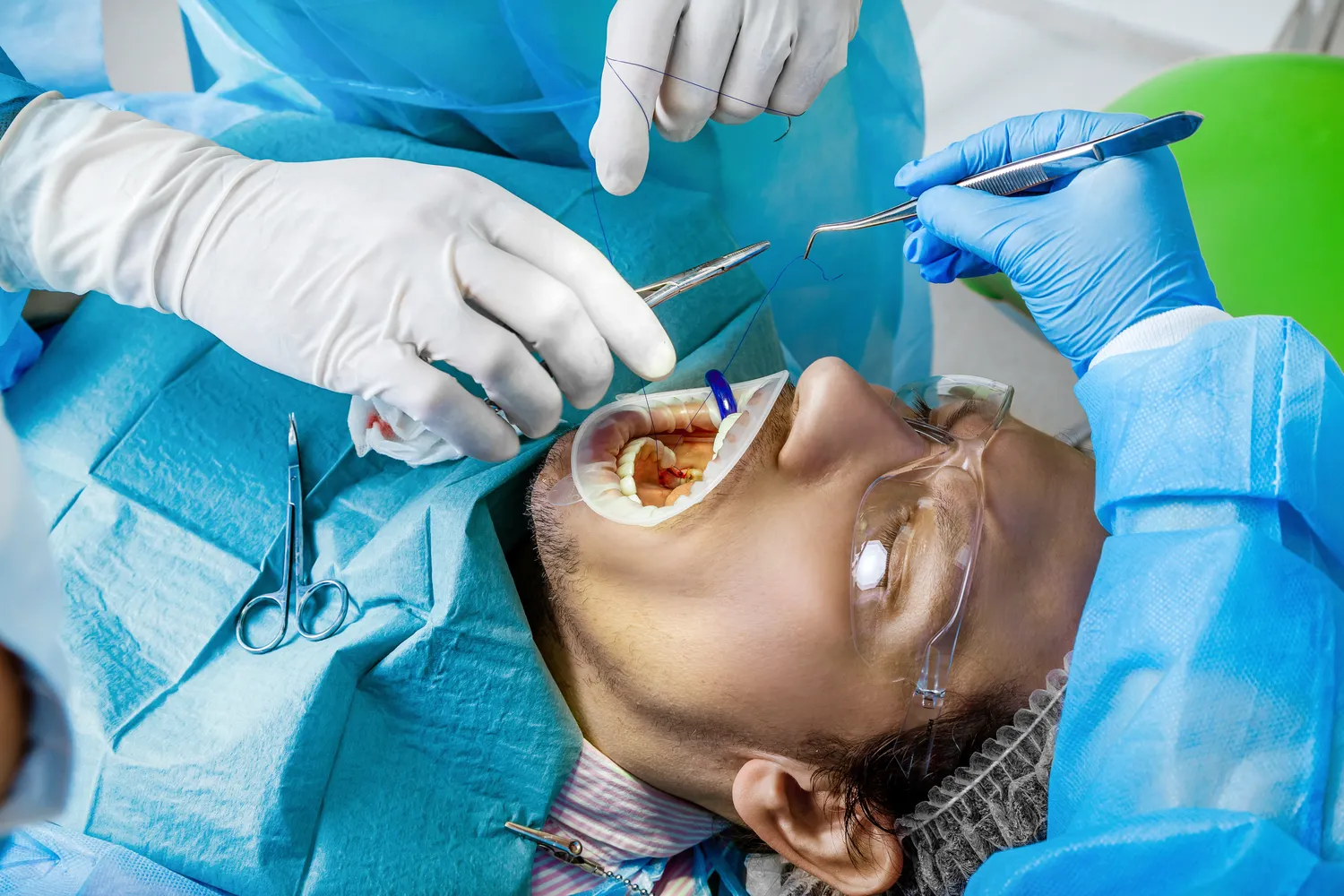 E recepta antykoncepcja na ile dni stosowania?