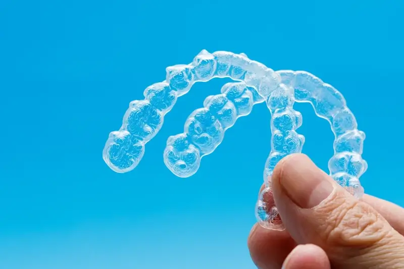 Ile kosztują nakładki Invisalign?