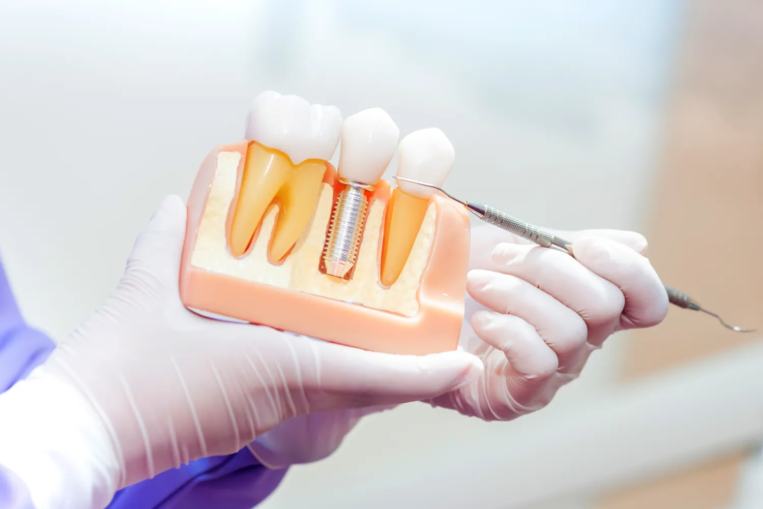Najlepsza endodoncja Szczecin